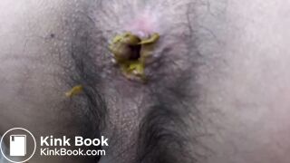 Peeping an Asian Guy Dirty Hole Close Up