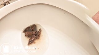 Pooping 672 - Swinging Turd