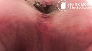 Pooping 630 - Dirty Butt Hole to Face