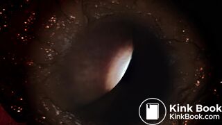 Pooping 537 - Poops Eye View