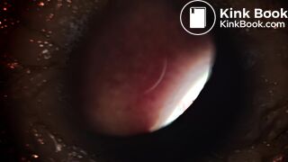Pooping 537 - Poops Eye View