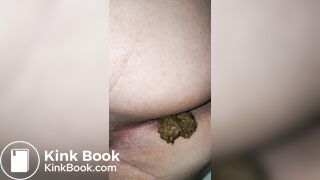 Pooping 527 - Walk, Dump, and Walk