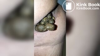 Pooping 514 - Quick Dump