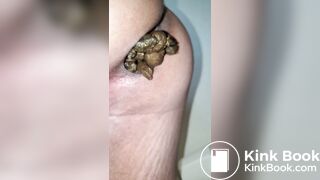 Pooping 514 - Quick Dump