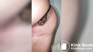 Pooping 514 - Quick Dump