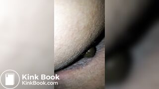 Pooping 514 - Quick Dump