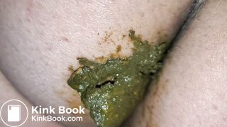 Pooping 401 - Walking the Poop