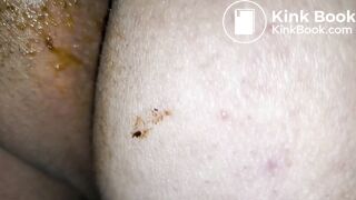 Pooping 269 - Poop Fun, Finger Food