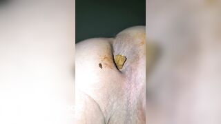 Pooping 239 - Walking the Poop (sorry too shaky)