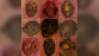 Extreme Closeups of My Anus As It Poos