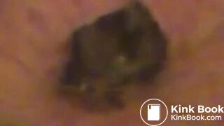 Extreme Closeups of My Anus As It Poos