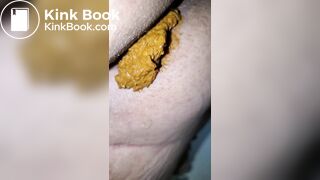 Pooping 231 - Two Dumps within an Hour