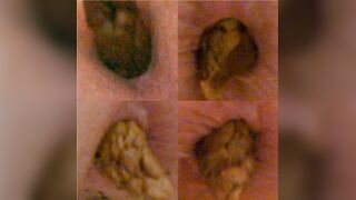 4 Dumps