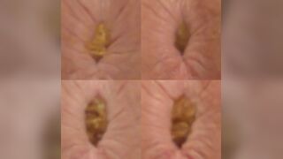 Which Anus Produced the Biggest Pile of Poo?