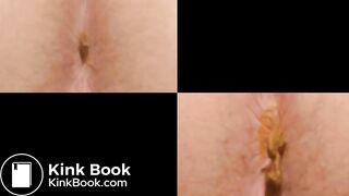 Which Anus Produced the Biggest Pile of Poo?