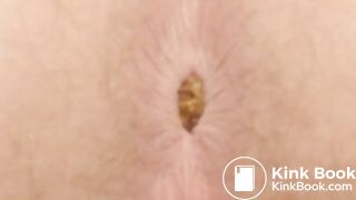 Which Anus Produced the Biggest Pile of Poo?