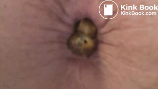 9 Dumps Video (Part II)
