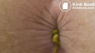 9 Dumps Video (Part II)
