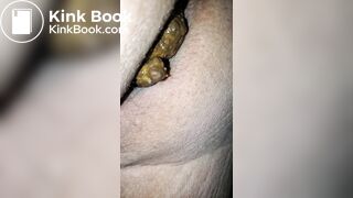 Pooping 199 - Hard Dump