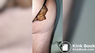 Pooping 199 - Hard Dump