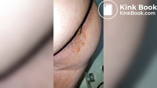 Pooping 199 - Hard Dump