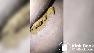 Pooping 185 - Long Logs