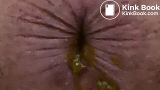 4 Stinky Diarrhea Dumps