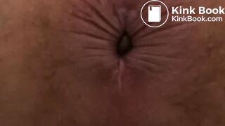 4 Stinky Diarrhea Dumps