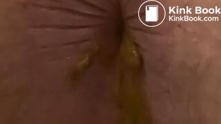 4 Stinky Diarrhea Dumps