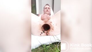 Ich Drecksau aus Dortmund habe Hundescheiße in meine offene Arschfotze gelegt.
