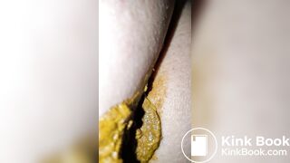 Pooping 38 - Walking the Poop - Compressed
