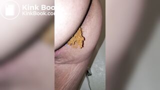 Pooping 24 - Hair Up My Butt