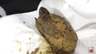 Japanese Girl Pooping