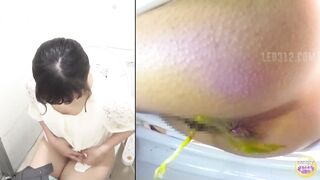 Japanese Girl Diarrhea