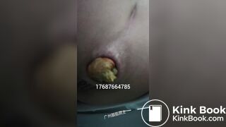 Chinese Girl Pooping
