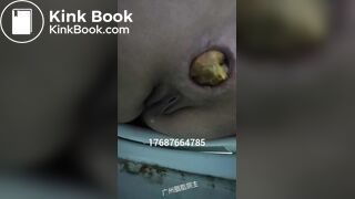 Chinese Girl Pooping